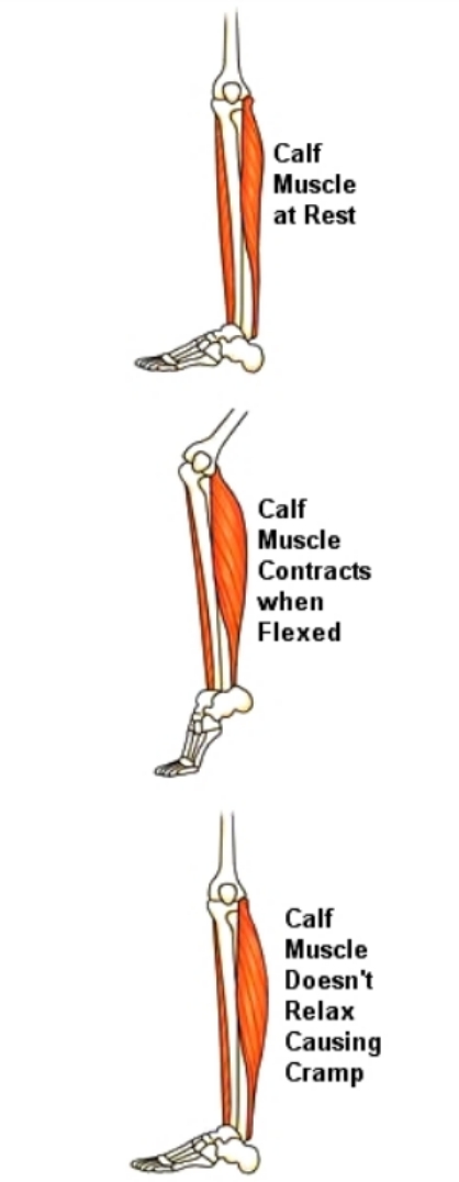 How exercise affects the calf muscle