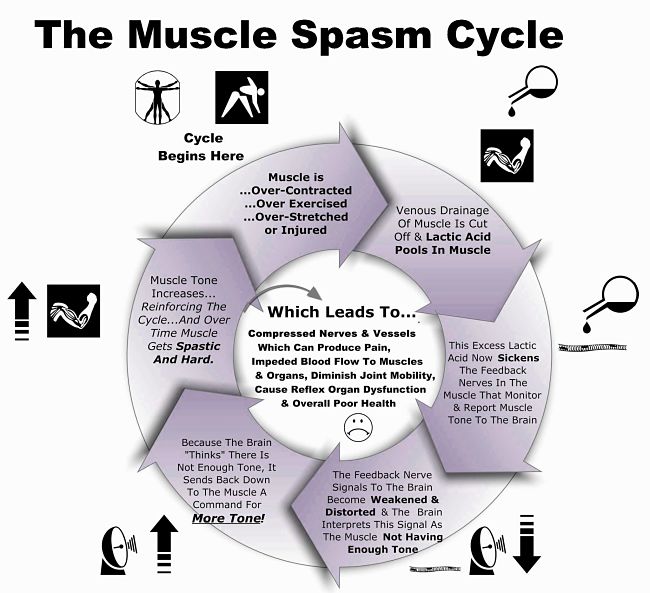 The muscle spasm cycle and how to break out of it, and prevent it