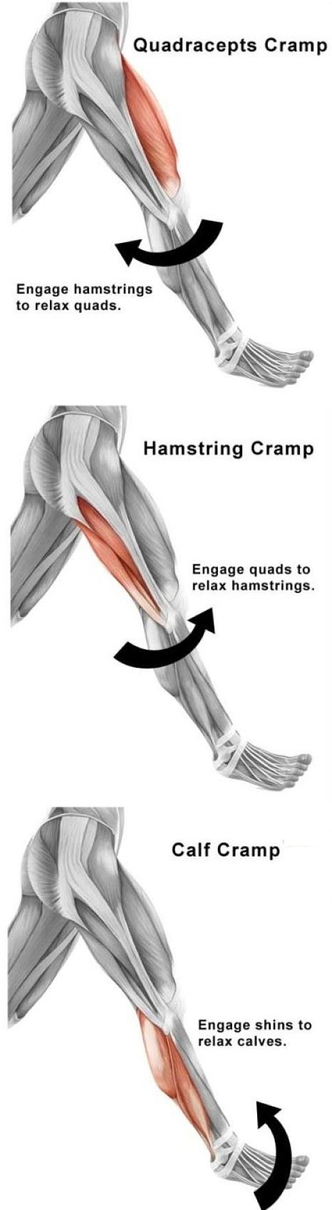 Types of leg cramps and which muscles are affected - see more details about the causes here
