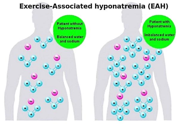 Drinking too much water can dilute the Sodium levels in the blood and tissues leading to life threatening swelling of the brain (Exercise-Associated hyponatremia (EAH)